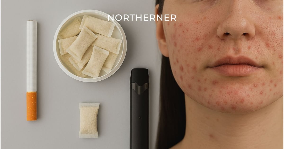 Does Nicotine Cause Acne? | Skin Health & Nicotine Explained