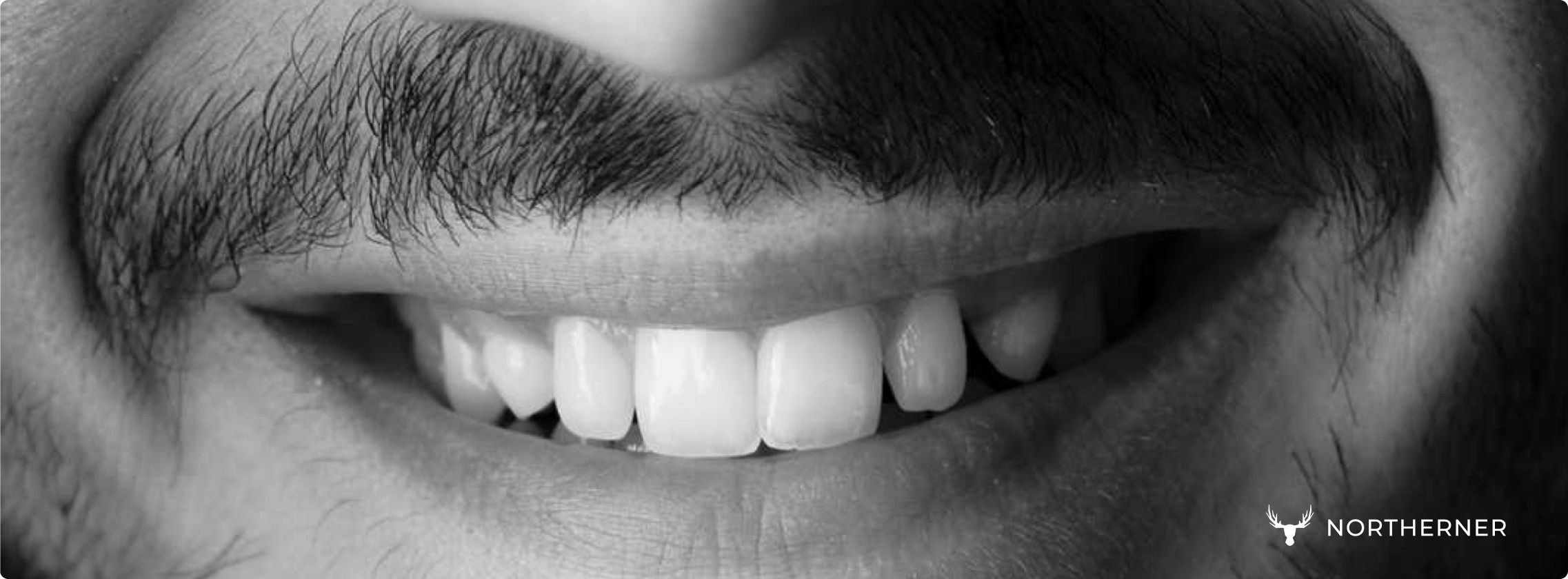 Person smiling, symbolising snus effects on gums